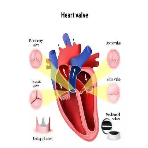 Heart Valve Repair