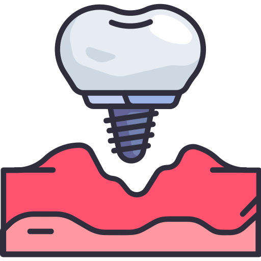 Implant Dentistry