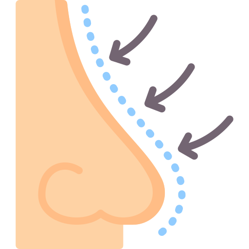 rhinoplasty