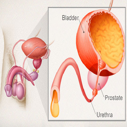 urinary-incontinence