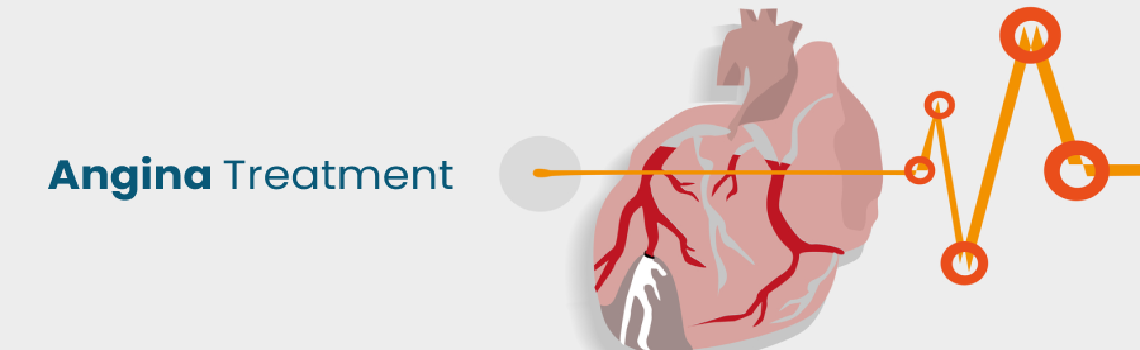 angina-treatment