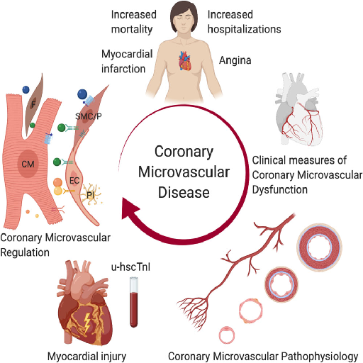 Microvascular Dysfunction
