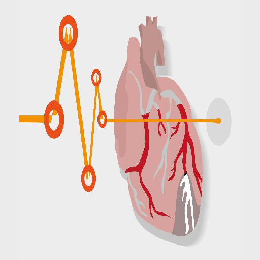 cardiac-arrest