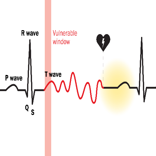commotio-cordis