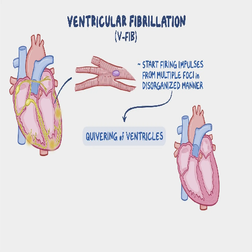 VF