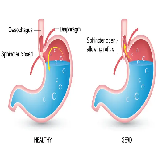 gastrointestinal