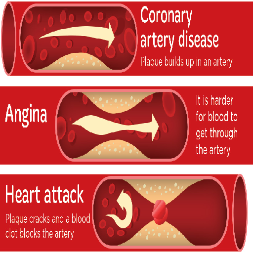 Heart-Related Causes