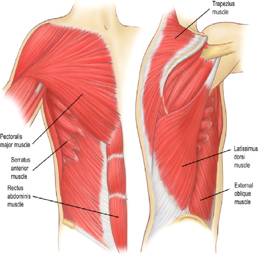 musculoskeletal-cause