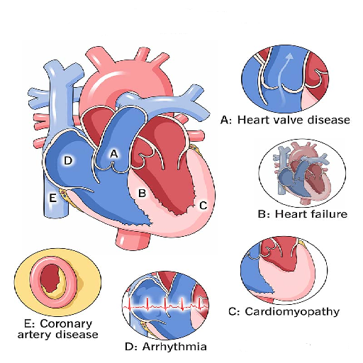 heart-related-disease