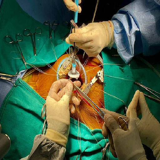 Surgical