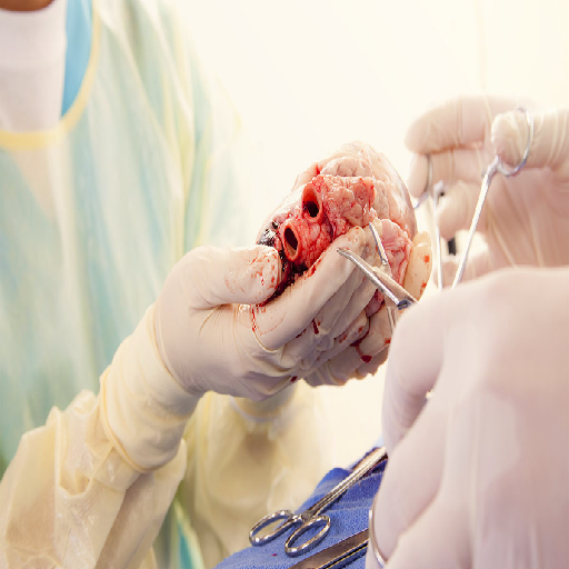 heart-transplant