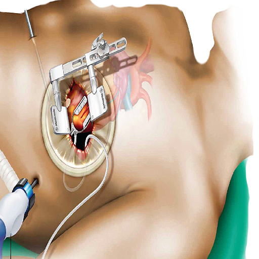 minimally-invasive