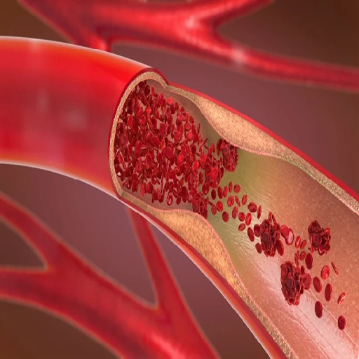 Restored Blood Flow